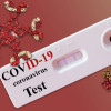 COVID-19 antibody test
