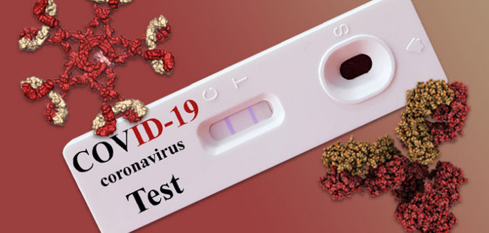 COVID-19 antibody test