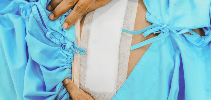 Hysterectomy surgery