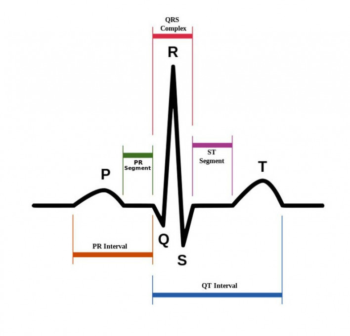 Normal sinus rhythm on ECG