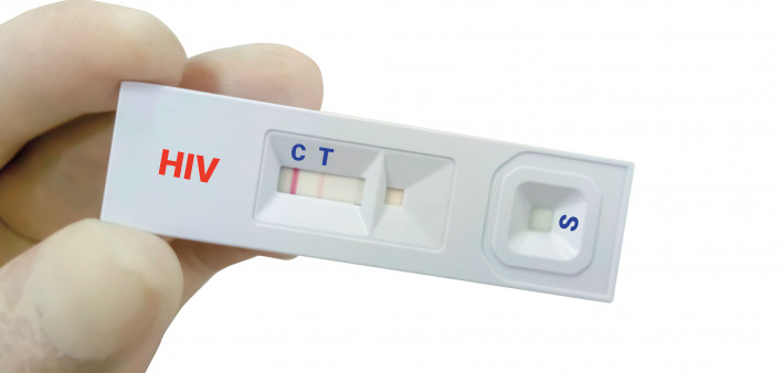 rapid hiv test