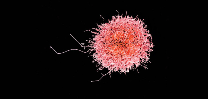 Colorized scanning electron micrograph of a natural killer cell from a human donor