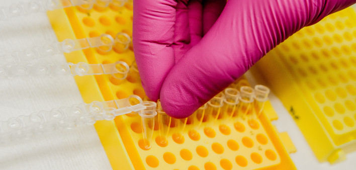 genetic testing