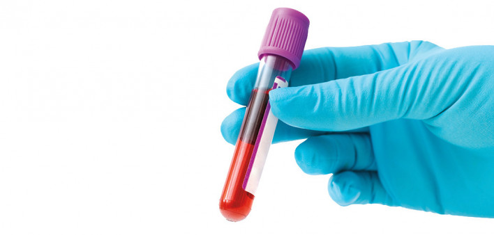 blue gloved hands holding blood vial