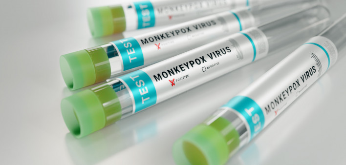 monkeypox virus