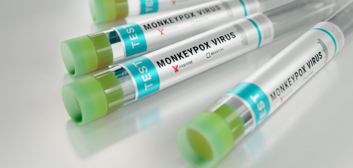 monkeypox virus