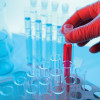 vials and beakers test tubes red liguid lab