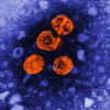 Transmission electron micrograph of hepatitis B virus particles