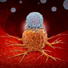 CAR-T therapy in which modified T cells (illustrated in white) attack cancer