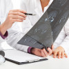 Evaluation of brain MRI scan