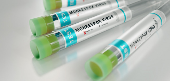 monkeypox virus