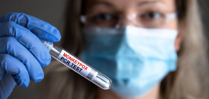 monkypox pcr test in test tube