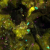 Human skin cells (yellow) play host to a broad array of bacteria (pink), fungi (blue) and other microbes.