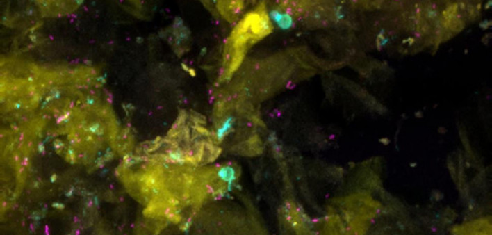 skin cells and bacteria amid side effects of immunotherapy