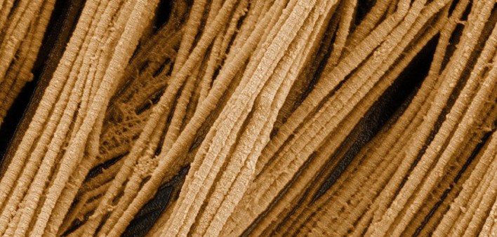 a protein called collagen might help in pancreatic cancer