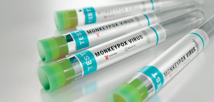 tubes monkeypox virus