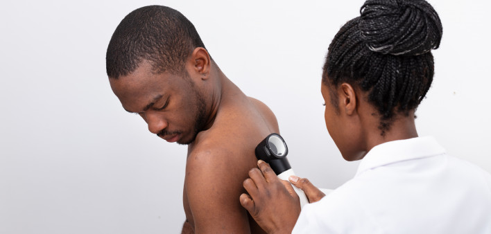 skin cancer screening black man