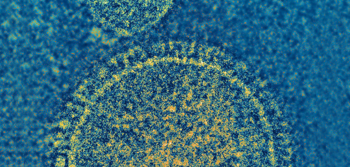 Image of respiratory syncytial virus (RSV)