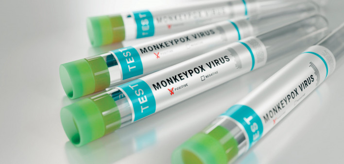 tubes monkeypox virus