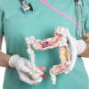 Colon cancer
