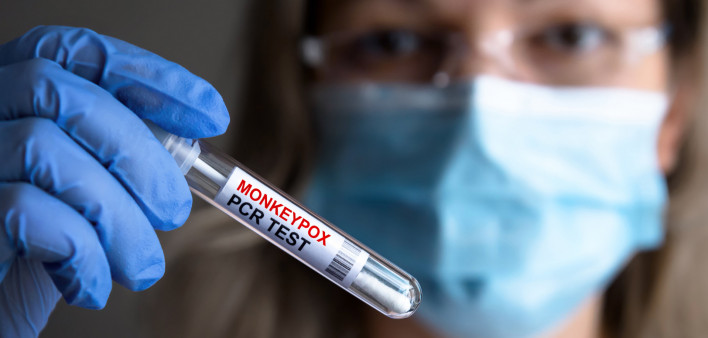 monkypox pcr test in test tube
