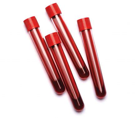 vials of blood with red tops