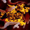 Novel coronavirus SARS-CoV-2