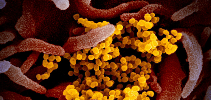 Novel coronavirus SARS-CoV-2