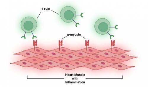 immunotherapy myocardititis T cells heart