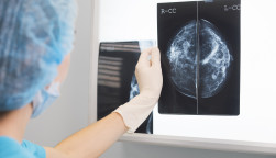 Woman doctor or nurse in surgery outfit is holding a mammogram in front of x-ray illuminator stock photo