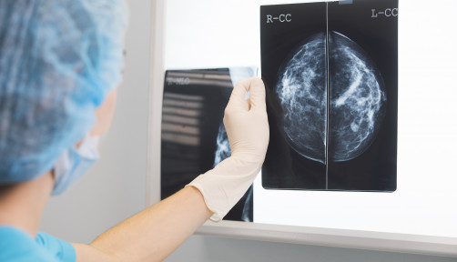 Woman doctor or nurse in surgery outfit is holding a mammogram in front of x-ray illuminator stock photo