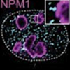 Condensates of MED1 (cyan) and positive transcription regulators (magenta)