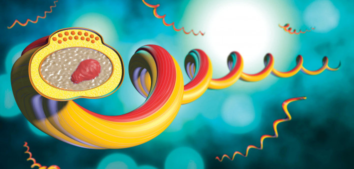 illustration of Syphilis