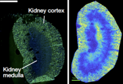 tracking cancer cell metabolism