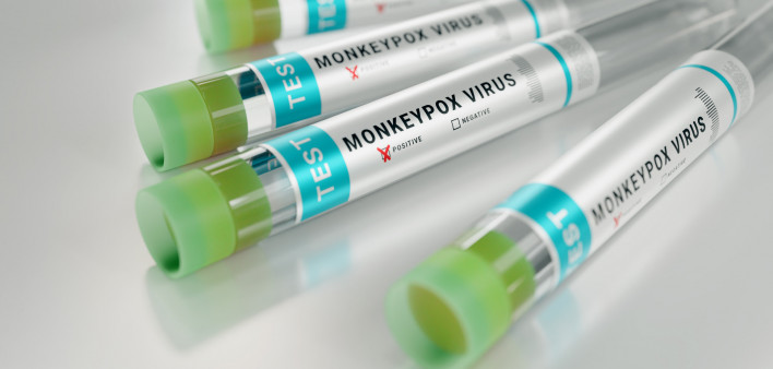 monkeypox virus