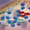 Multiple myeloma cells