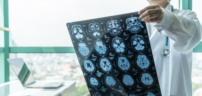 doctor looking at mri of brain