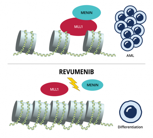 Revumenib Shows Promise for Advanced Acute Myeloid Leukemia