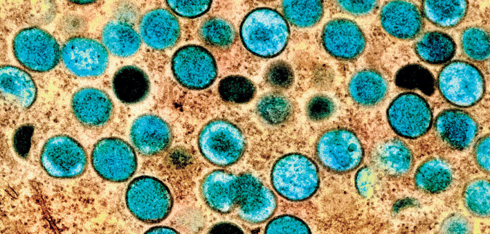 Monkeypox virus