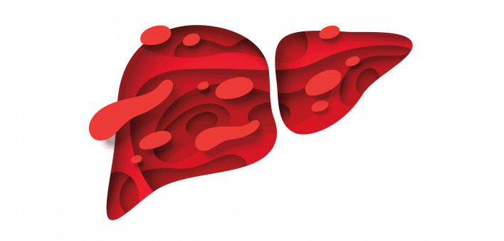 liver illustration showing disease