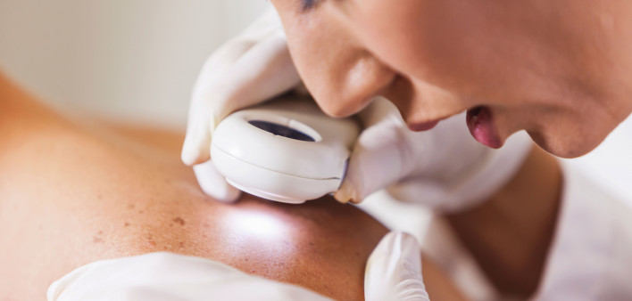 Dermatologist looking at skin with a magnifier skin cancer check