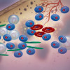 Multiple myeloma cells
