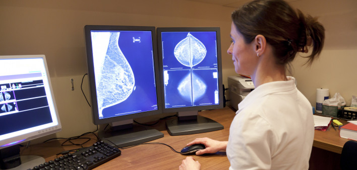 Photo about Radiology technician examens mammography test. Image of technician, horizontal, radiology