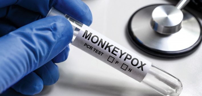 MonkeyPOX on test tube