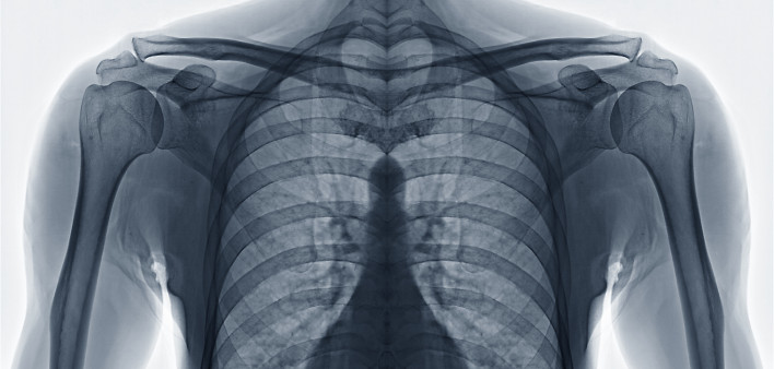 chest x ray