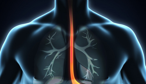 esophagus, throat, stomach, gastric, digestive tract