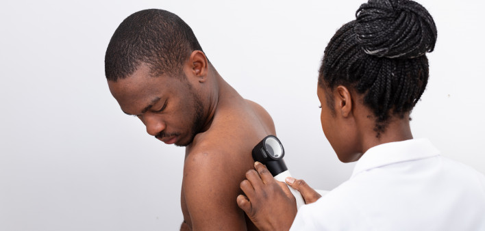skin cancer screening black man