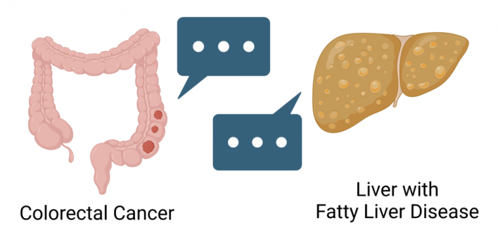 How Fatty Liver Disease Helps Cancer Thrive in the Liver NAFLD, NASH