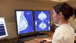 Photo about Radiology technician examens mammography test. Image of technician, horizontal, radiology