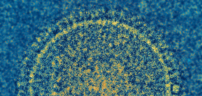 Image of respiratory syncytial virus (RSV)